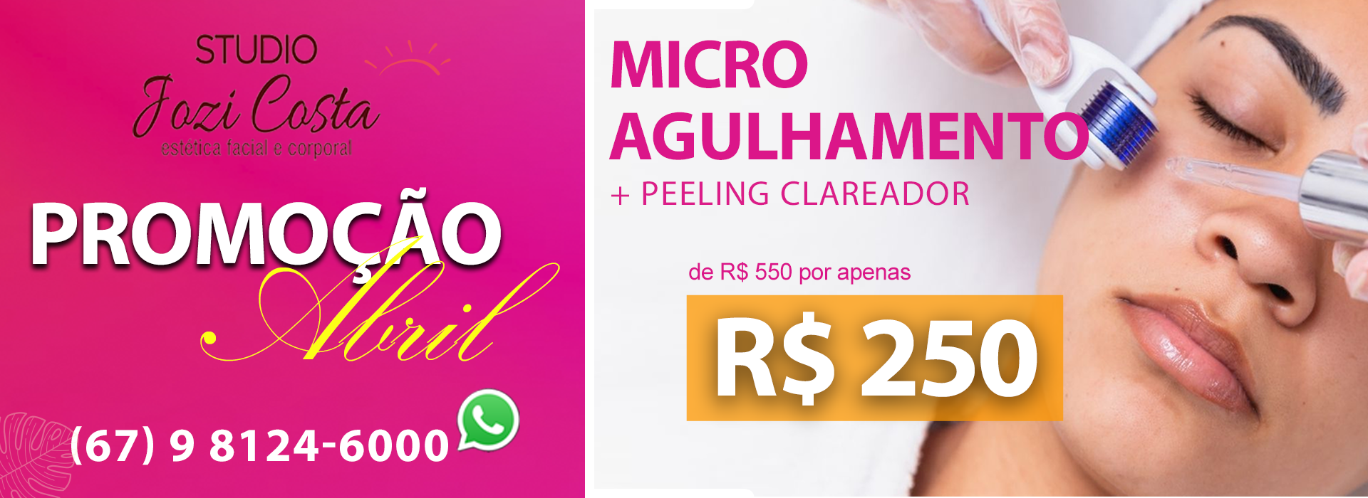 /imagens/vitrine/microagulhamento220413.png