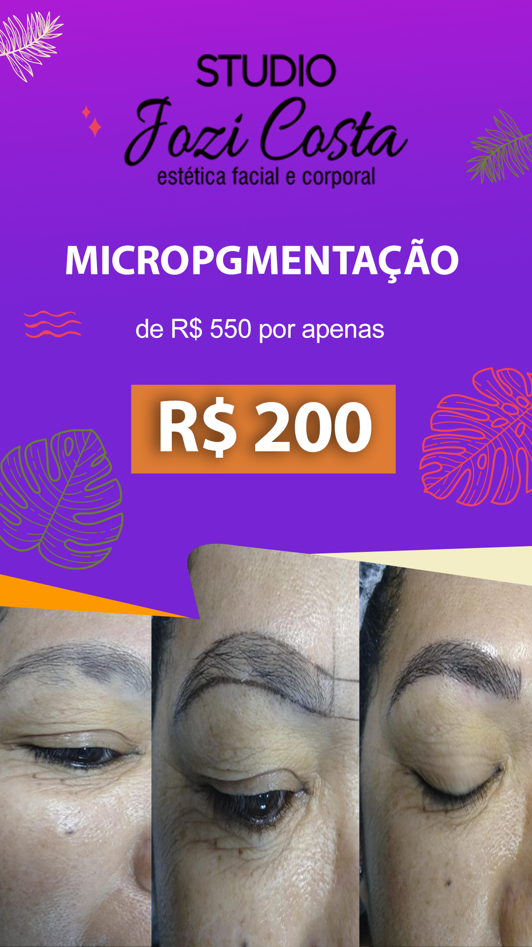 /imagens/vitrine/micropigmenta-o-site220450.png