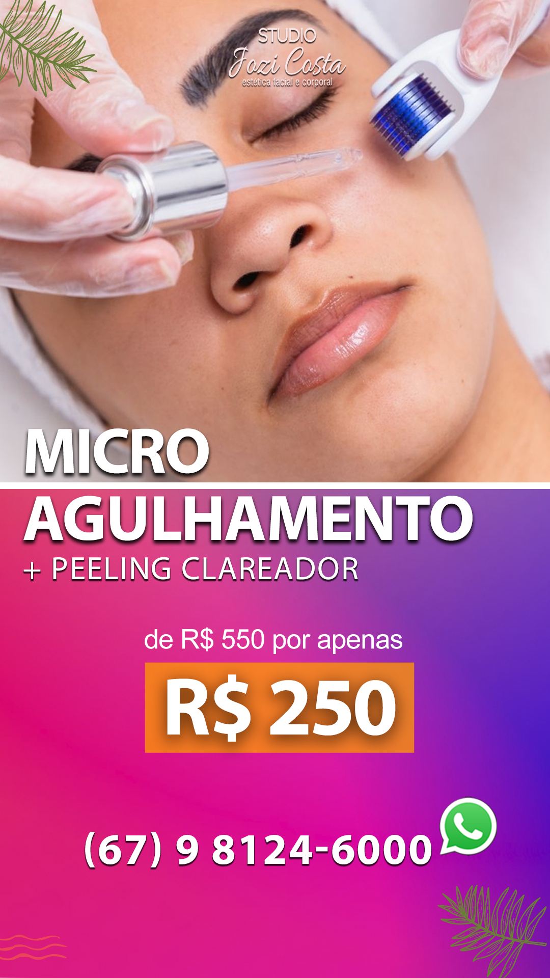 /imagens/vitrine/microagulhamento220413.png